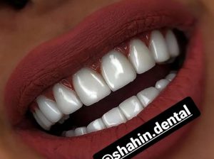 کلینیک دندانپزشکی و زیبایی شاهین دنتال