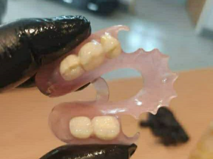 ساخت و ترمیم دندان مصنوعی در ۲۴ ساعت