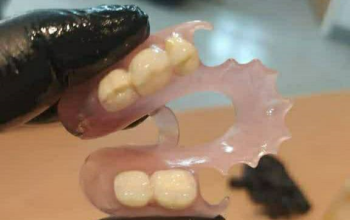 ساخت و ترمیم دندان مصنوعی در ۲۴ ساعت